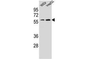 Western blot analysis of HOXA10 / HOX1H Antibody (Center) in WiDr, HepG2 cell line lysates (35ug/lane). (HOXA10 antibody  (Middle Region))