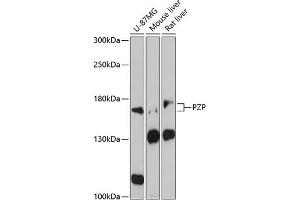 Western blot analysis of extracts of various cell lines, using PZP antibody (ABIN1682416, ABIN3017699, ABIN3017700 and ABIN6220213) at 1:3000 dilution. (PZP antibody  (AA 620-740))