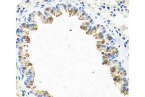 Immunohistochemistry of paraffin-embedded Mouse lung using GNRH2 Polyclonal Antibody at dilution of 1:100 (40x lens). (GnRH2 antibody)