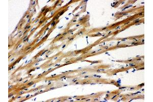 Anti-Presenilin 2 antibody, IHC(P) IHC(P): Rat Cardiac Muscle Tissue