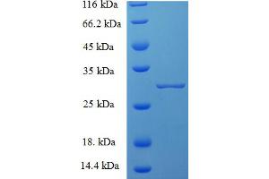 SDS-PAGE (SDS) image for Chymase 1, Mast Cell (CMA1) (AA 22-146), (partial) protein (His tag) (ABIN5709297) (CMA1 Protein (AA 22-146, partial) (His tag))