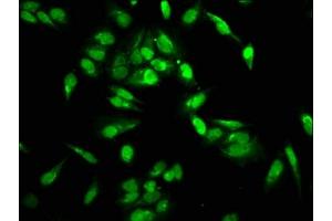 Immunofluorescence staining of Hela cells with ABIN7139580 at 1:2. (HIST1H2AG antibody  (meArg29))