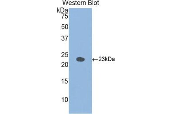 GAA antibody  (AA 755-953)