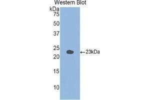 Detection of Recombinant GaA, Mouse using Polyclonal Antibody to Glucosidase Alpha, Acid (GaA) (GAA antibody  (AA 755-953))