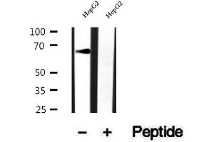 Western blot analysis of extracts of HepG2 cells, using RNF156 antibody.