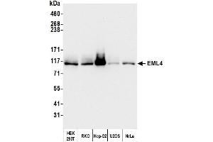 Western Blotting (WB) image for anti-Echinoderm Microtubule Associated Protein Like 4 (EML4) (AA 931-981) antibody (ABIN7454794)