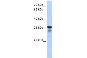 LAPTM4B antibody used at 1 ug/ml to detect target protein. (LAPTM4B antibody  (Middle Region))