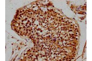 IHC image of ABIN7176072 diluted at 1:300 and staining in paraffin-embedded human testis tissue performed on a Leica BondTM system. (ZIM2 antibody  (AA 1-124))