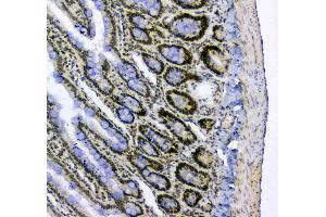 IHC analysis of splicing factor 1 using anti-splicing factor 1 antibody . (Splicing Factor 1 antibody  (AA 160-266))