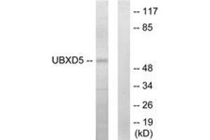 Western blot analysis of extracts from HepG2 cells, using UBXD5 Antibody.