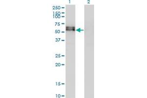 Western Blot analysis of ACVR1 expression in transfected 293T cell line by ACVR1 monoclonal antibody (M07), clone 2D5. (ACVR1 antibody  (AA 21-120))