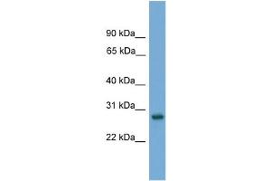 WB Suggested Anti-Abt1 Antibody Titration: 0. (Activator of Basal Transcription 1 antibody  (Middle Region))
