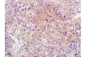 L1 human colon carcinoma lysates L2 rat brain lysates probed with Anti GPR15 Polyclonal Antibody, Unconjugated (ABIN702835) at 1:200 overnight at 4 °C. (GPR15 antibody  (AA 51-150))