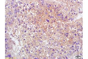 L1 human colon carcinoma lysates L2 rat brain lysates probed with Anti GPR15 Polyclonal Antibody, Unconjugated (ABIN702835) at 1:200 overnight at 4 °C.