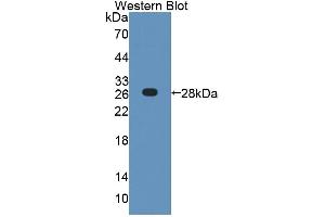 Detection of Recombinant COL4a4, Human using Polyclonal Antibody to Collagen Type IV Alpha 4 (COL4a4) (Col4a4 antibody  (AA 1469-1690))