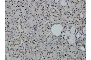 Immunoperoxidase of monoclonal antibody to SAFB on formalin-fixed paraffin-embedded human salivary gland. (SAFB antibody  (AA 111-200))