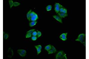Immunofluorescence staining of PC-3 cells with ABIN7155709 at 1:33, counter-stained with DAPI. (Homeobox A11 antibody  (AA 115-176))