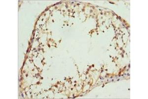 Immunohistochemistry of paraffin-embedded human testis tissue using ABIN7167019 at dilution of 1:100 (RACGAP1 antibody  (AA 353-632))