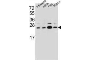 Western Blotting (WB) image for anti-Signal Sequence Receptor, beta (Translocon-Associated Protein Beta) (SSR2) antibody (ABIN2997190) (SSR2 antibody)