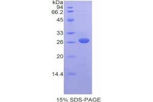 SDS-PAGE analysis of Mouse FATP5 Protein. (SLC27A5 Protein)