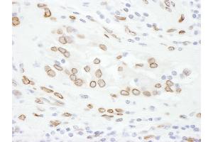 Immunohistochemistry (IHC) image for anti-Lamin A/C (LMNA) (AA 550-600) antibody (ABIN7454915)