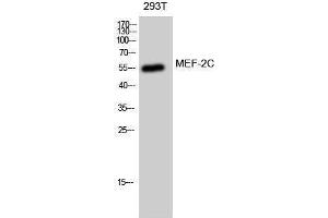 Western Blotting (WB) image for anti-Myocyte Enhancer Factor 2C (MEF2C) (Ser893) antibody (ABIN3175961) (MEF2C antibody  (Ser893))