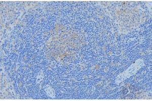 ABIN6276985 at 1/100 staining Human lymph node tissue by IHC-P. (PGK1 antibody  (Internal Region))