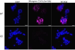 Immunocytochemical staining of HeLa cells using Phospho-CDC6 (Ser106) antibody (ABIN7798017), 1:1,000), Top panel: wild-type (WT), Bottom panal: Phospho-CDC6 (Ser106) shRNA knockdown (KD). (Recombinant CDC6 antibody  (pSer106))