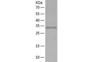 Western Blotting (WB) image for Ribosomal Protein, Large, P0 (RPLP0) (AA 1-317) protein (His tag) (ABIN7285417) (RPLP0 Protein (AA 1-317) (His tag))
