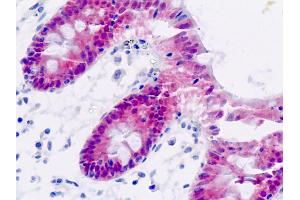 Human, Colon: Formalin-Fixed Paraffin-Embedded (FFPE) (AKR7A3 antibody)