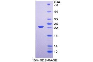 SDS-PAGE (SDS) image for Fibroblast Growth Factor 6 (FGF6) (AA 39-208) protein (His tag) (ABIN1980619)