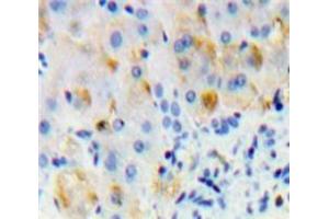 Used in DAB staining on fromalin fixed paraffin-embedded Liver tissue (Oncostatin M Receptor antibody  (AA 503-749))