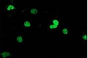 Anti-UBA2 mouse monoclonal antibody (ABIN2454287) immunofluorescent staining of COS7 cells transiently transfected by pCMV6-ENTRY UBA2 (RC201288). (UBA2 antibody)