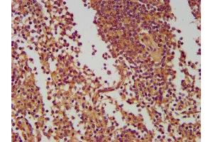 IHC image of ABIN7165873 diluted at 1:400 and staining in paraffin-embedded human spleen tissue performed on a Leica BondTM system. (NLRC5 antibody  (AA 95-208))