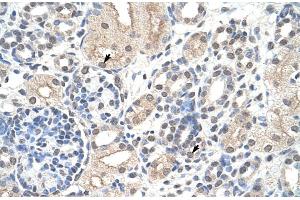 Rabbit Anti-NCL Antibody Catalog Number: ARP40583 Paraffin Embedded Tissue: Human Kidney Cellular Data: Epithelial cells of renal tubule Antibody Concentration: 4. (Nucleolin antibody  (N-Term))