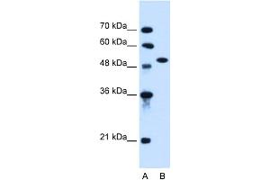 WB Suggested Anti-ACVR1 Antibody Titration:  0.