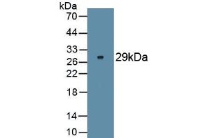 Detection of Recombinant FOXP3, Human using Monoclonal Antibody to Forkhead Box P3 (FOXP3) (FOXP3 antibody  (AA 191-412))