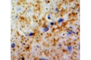 IHC-P analysis of Brain tissue, with DAB staining. (PLAUR antibody  (AA 221-305))