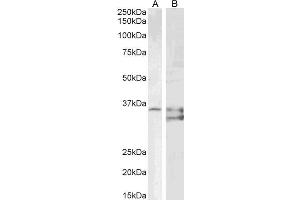 ABIN6391386 (1ug/ml) staining of PD19 (A) and (2µg/ml) K562 (B) cell lysate (35µg protein in RIPA buffer). (SGTA antibody  (AA 84-97))