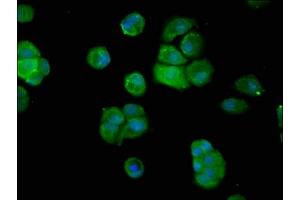 Immunofluorescence staining of MCF-7 cells with ABIN7144753 at 1:200, counter-stained with DAPI. (Aspartyl Aminopeptidase antibody  (AA 279-386))