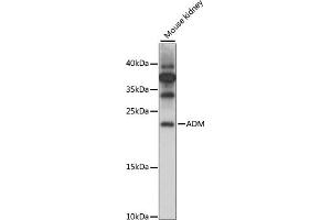 Western blot analysis of extracts of Mouse kidney, using ADM antibody (ABIN7265507) at 1:1000 dilution. (Adrenomedullin antibody  (AA 50-150))