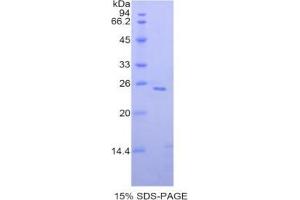 SDS-PAGE analysis of Human SIGLEC1 Protein. (Sialoadhesin/CD169 Protein)