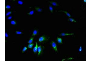 Immunofluorescent analysis of Hela cells using ABIN7153593 at dilution of 1:100 and Alexa Fluor 488-congugated AffiniPure Goat Anti-Rabbit IgG(H+L) (GJA4 antibody  (AA 231-333))