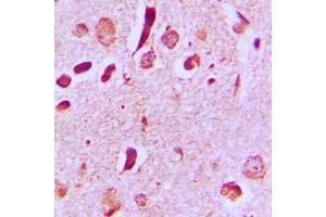 Immunohistochemical analysis of JIP3 staining in human brain formalin fixed paraffin embedded tissue section. (JIP3 antibody  (Center))