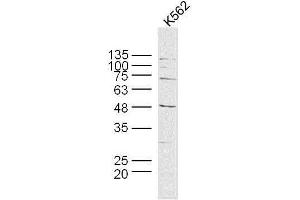 Human K562 cells probed with MAGEB6 Polyclonal Antibody, unconjugated  at 1:300 overnight at 4°C followed by a conjugated secondary antibody at 1:10000 for 90 minutes at 37°C.
