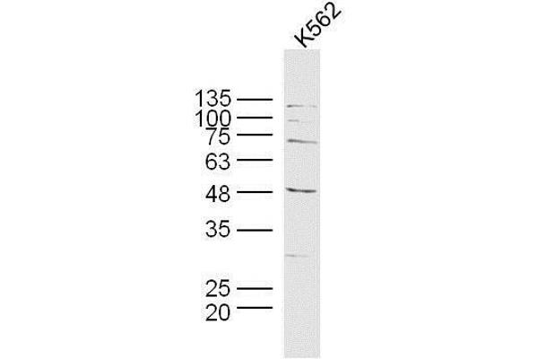 MAGEB6 Antikörper  (AA 151-250)