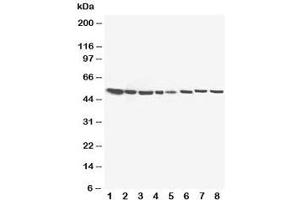 Western blot testing of 17-beta-Hydroxysteroid dehydrogenase 4 antibody and Lane 1:  rat liver;  2: (r) brain;  3: (r) testis;  4: (r) small intestine;  5: human SMMC-7721;  6: (h) HeLa;  7: (h) U87;  8: (h) COLO320