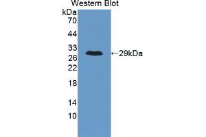 Figure. (ANGPTL6 antibody  (AA 238-457))