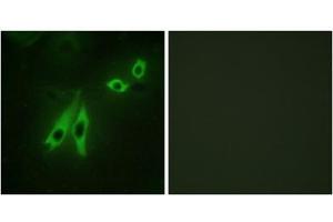 Immunofluorescence analysis of NIH/3T3 cells, using AKAP3 antibody. (AKAP3 antibody  (Internal Region))