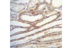 Immunohistochemistry analysis in human kidney tissue (Formalin-fixed, Paraffin-embedded) using Myosin-IIIb Antibody (C-term), followed by peroxidase conjugated secondary antibody and DAB staining. (MYO3B antibody  (C-Term))